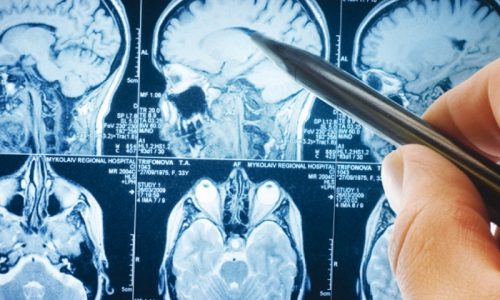 mri-5-website-size