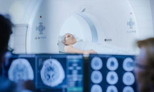 Towards better monitoring of MS using MRI measures